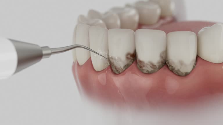 Trusted Teeth Cleaning And Checkup service in Great Neck, NY - Dentist Open Now